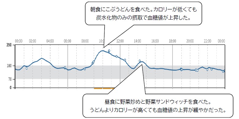 リブレ2装着の1例